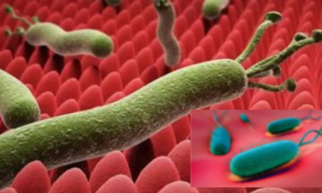 ما هي الجرثومة الحلزونية