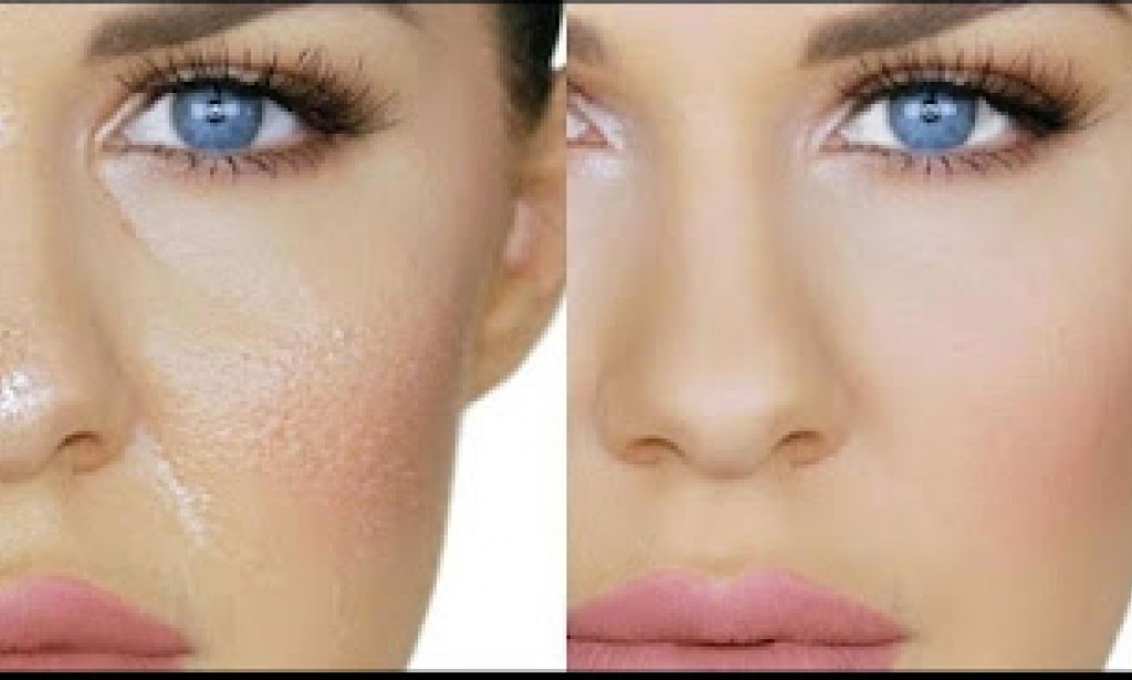 إليكي أهم نصائح الجمال للتخلص من البشرة الدهنية