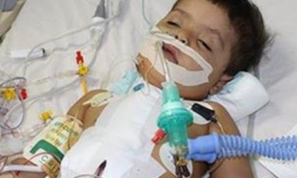 تجربتي مع عملية القلب المفتوح للأطفال