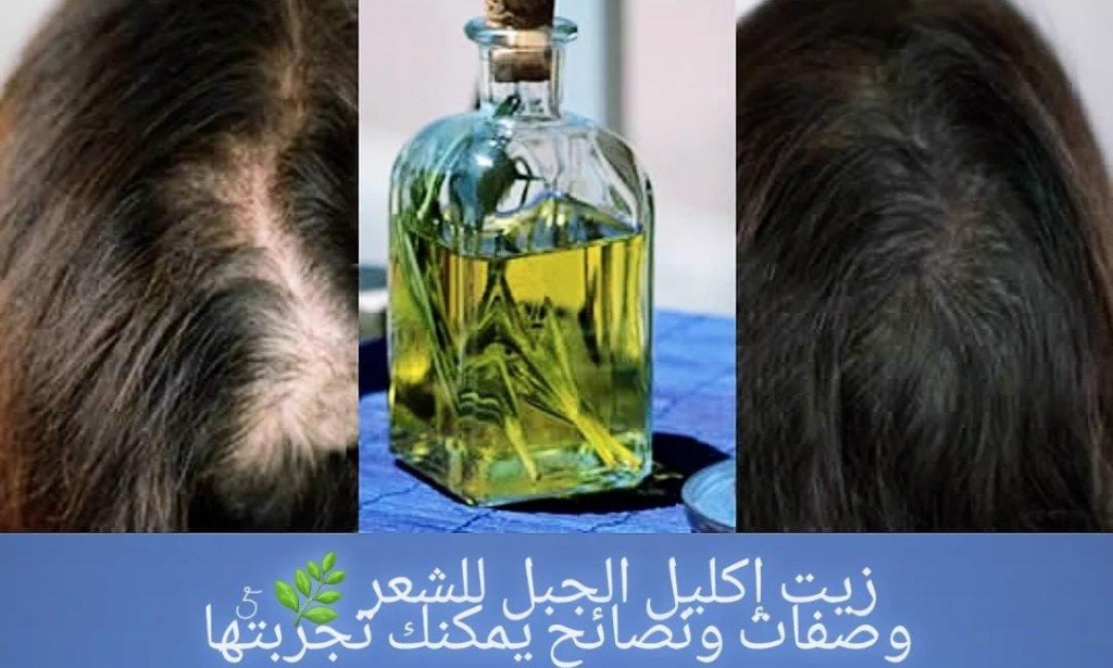 زيت إكليل الجبل للشعر 🌿 5 وصفات ونصائح يمكنك تجربتها