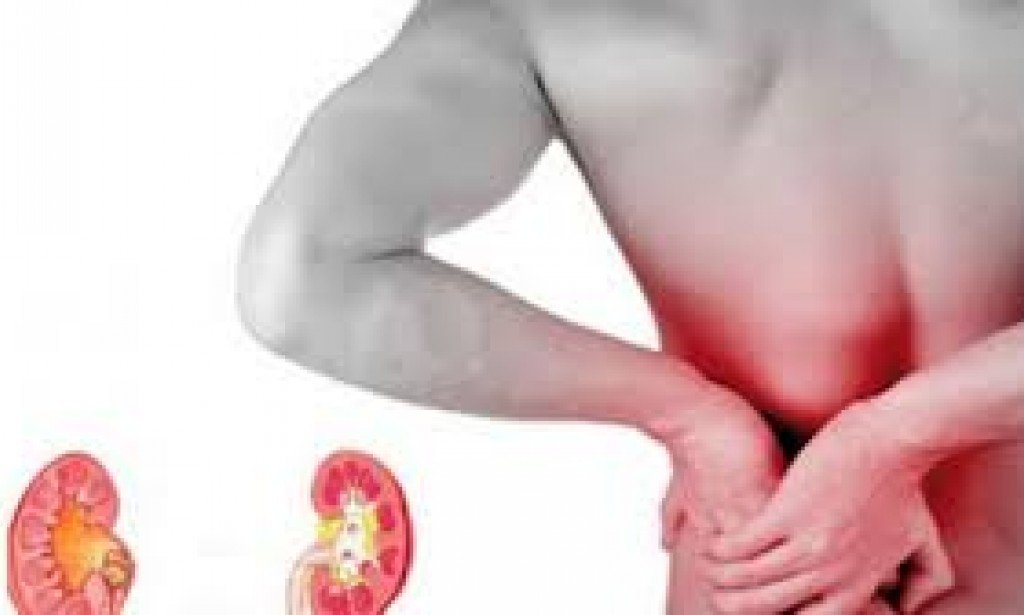 أعراض حصوات الكلى وانسداد الحالب وكيفية الوقاية والعلاج