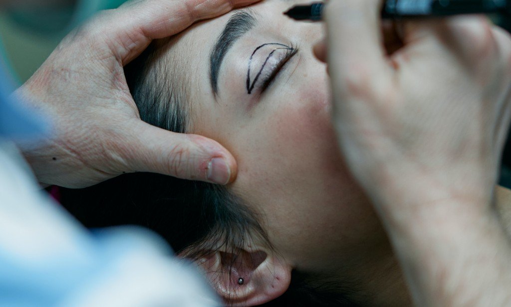 5 Things to Consider Before You Get a Nose Job