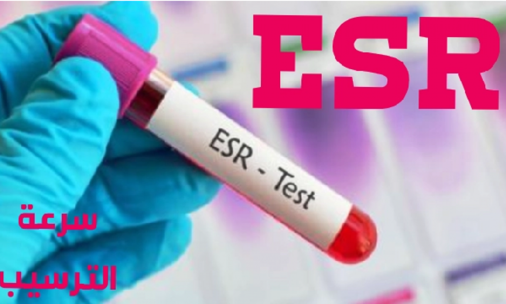 الأكلات الممنوعة لمرضى سرعة الترسيب