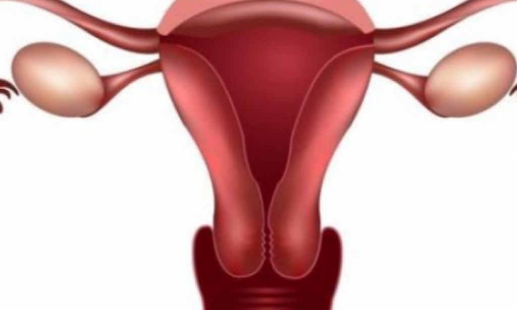 تعرف علي مرض اكياس الشوكولاته واسبابه وطرق علاجه