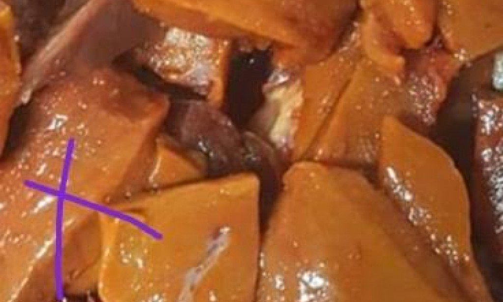 الكبدة المجمدة ظاهره لازم تعرفها