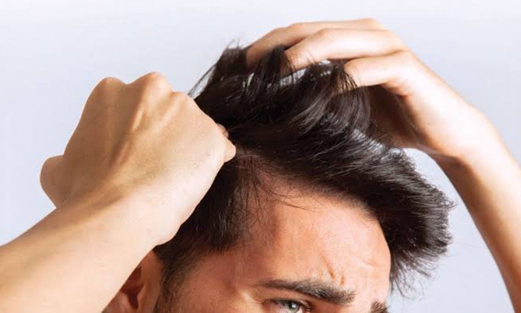 أفضل علاج طبيعي للقشرة