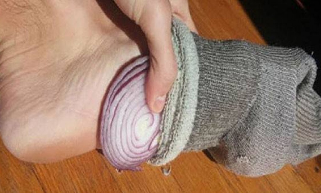 هل من الجيد للصحة وضع البصل في الجوارب ولبسها في الليل؟