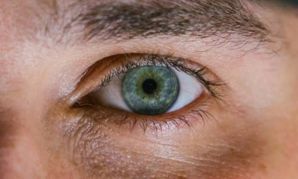 الهالات السوداء حول العين