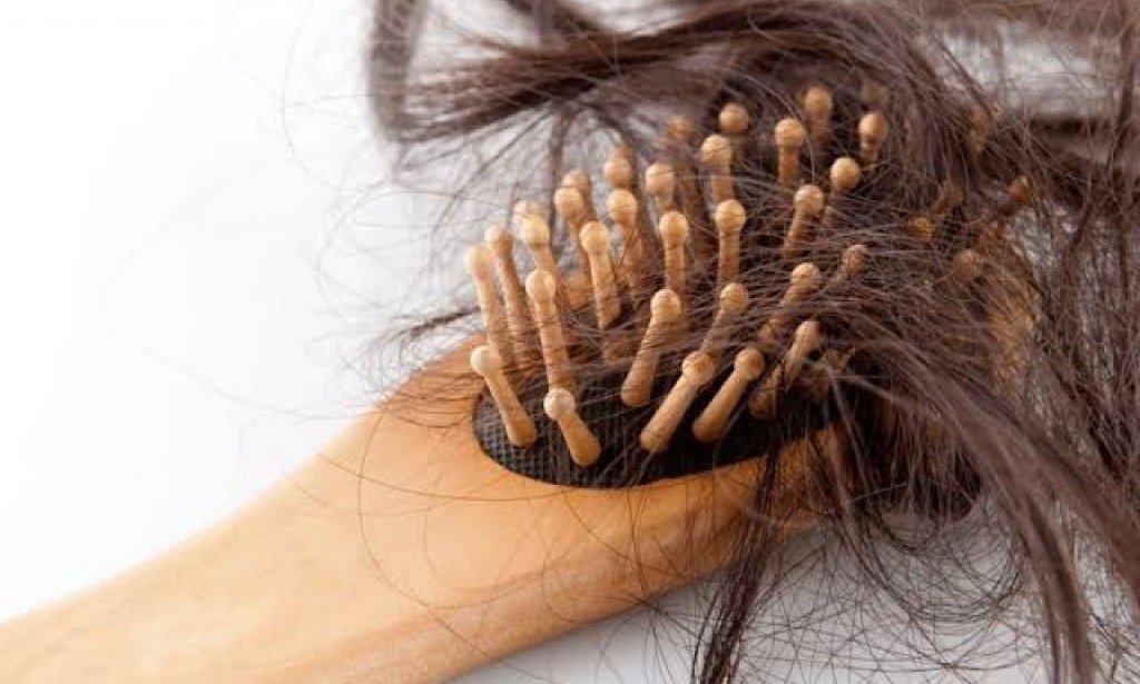 تساقط الشعر وأسبابه تعرف على أهمها