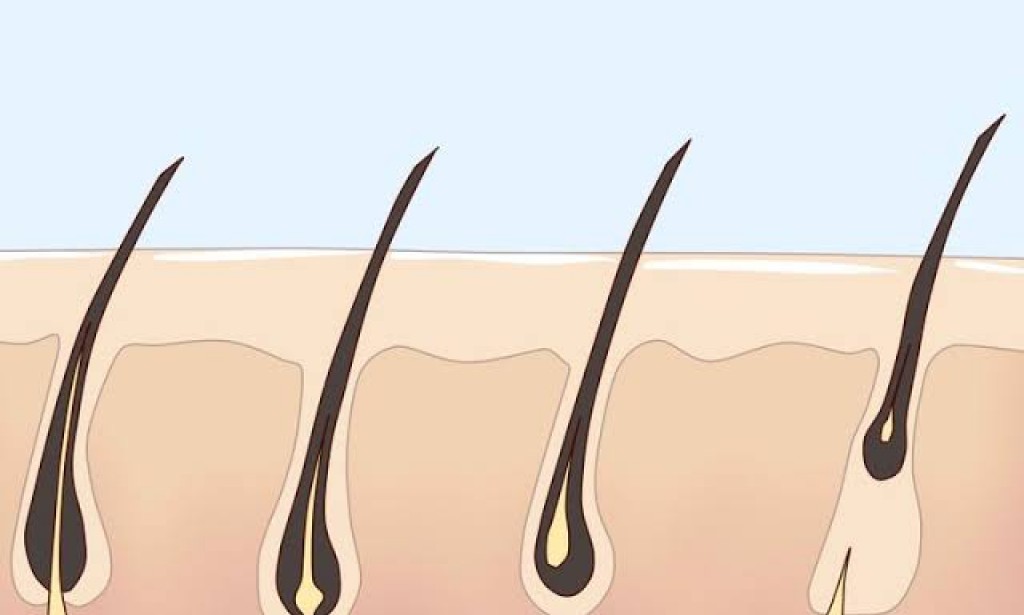 خلل الهرمونات من أسباب نمو الشعر الزائد بسرعة عند المرأة