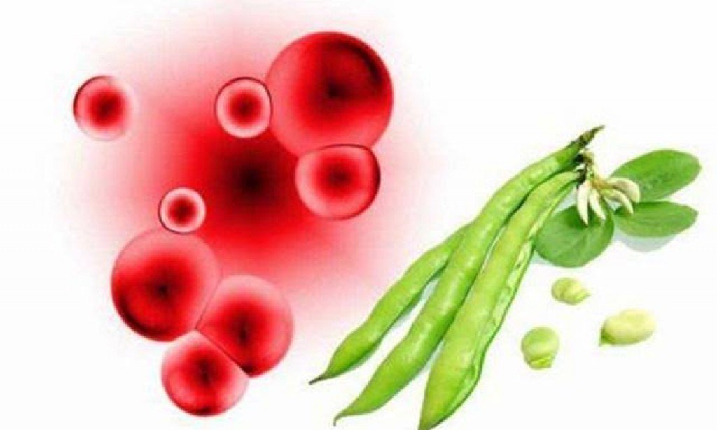 أعراض أنيميا الفول وطرق العلاج