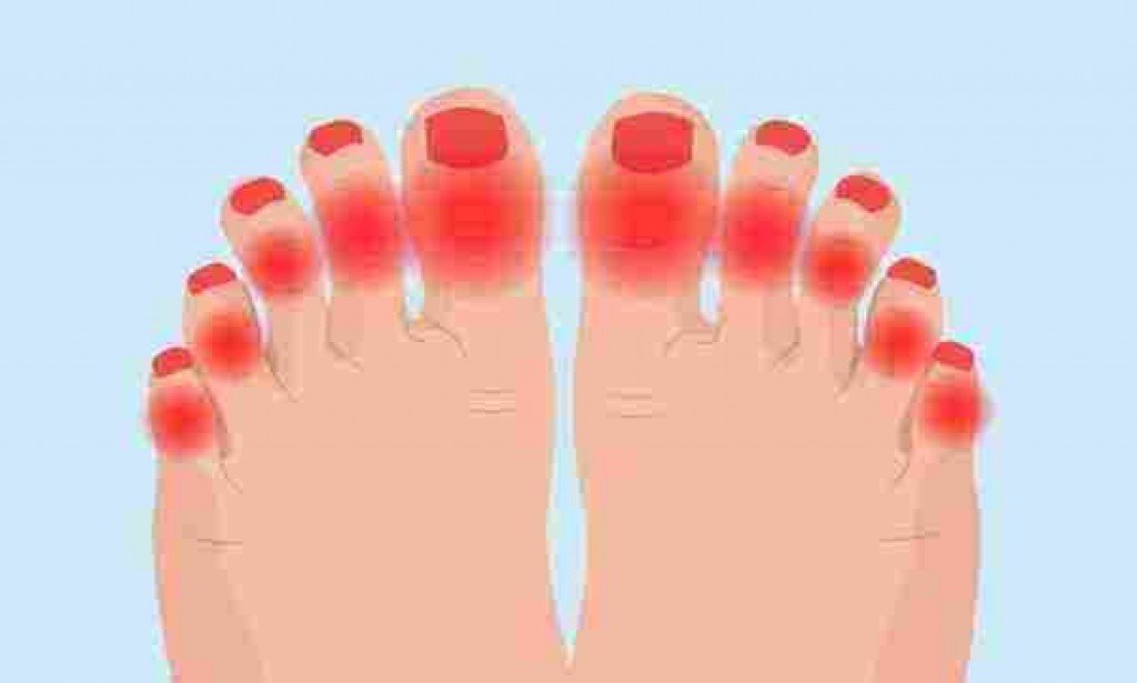 تورم الأصابع في الشتاء: الأسباب والعلاجات