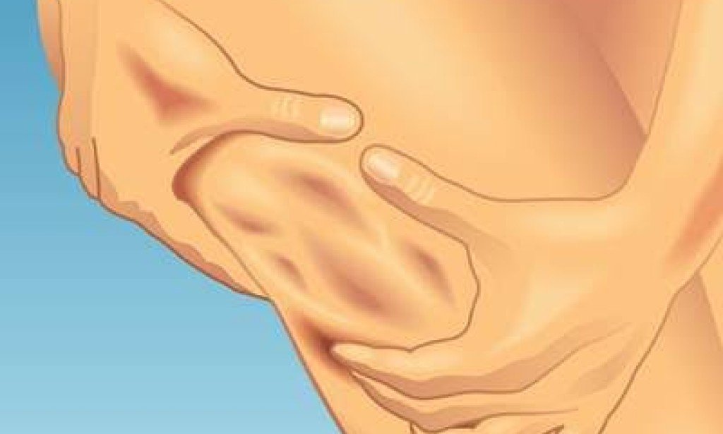 أفضل العلاجات الطبيعية لعلاج السيلوليت وترهل الجلد