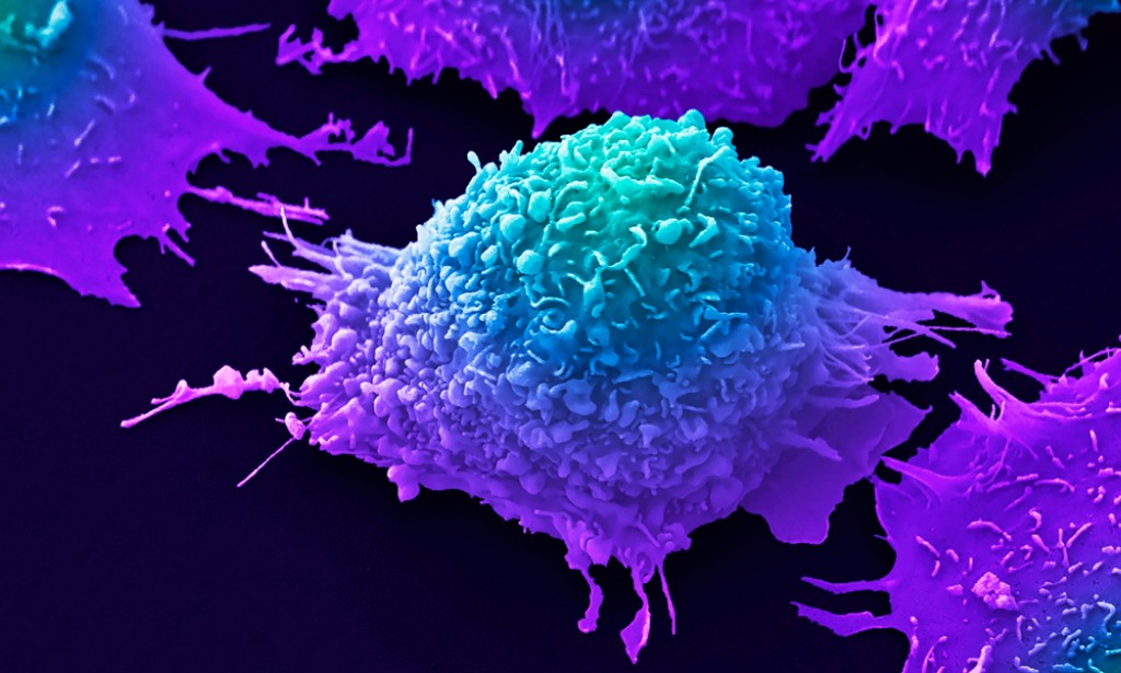 ?Is there a link between consuming sugar and the development of cancer