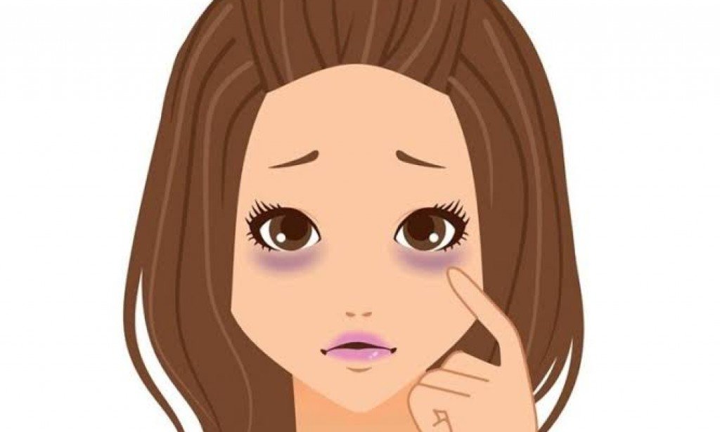 علاج الهالات السوداء تحت العين