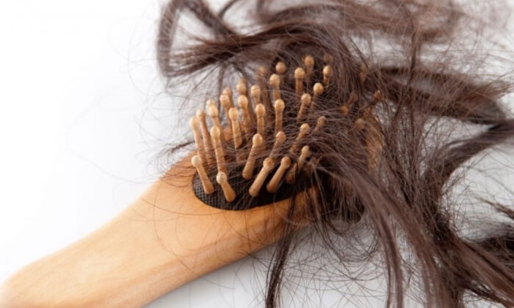 أفضل علاج لتساقط الشعر : قل وداعًا للبقع الصلعاء ومرحبًا برأس مليء بالشعر!