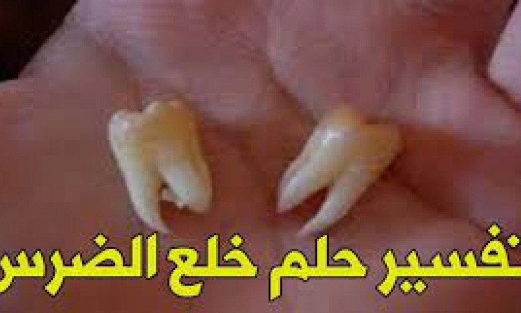 تفسير حلم خلع الضرس في المنام للعزباء