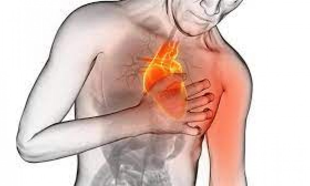 أعراض الذبحة الصدرية الكاذبة بالتفصيل