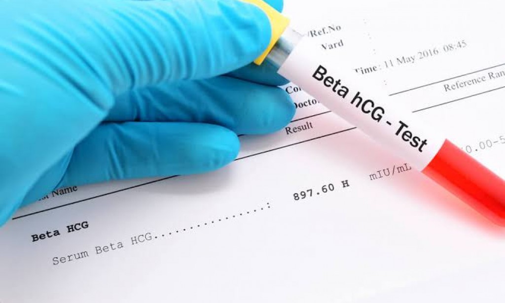كيفية قراءة تحليل beta hcg
